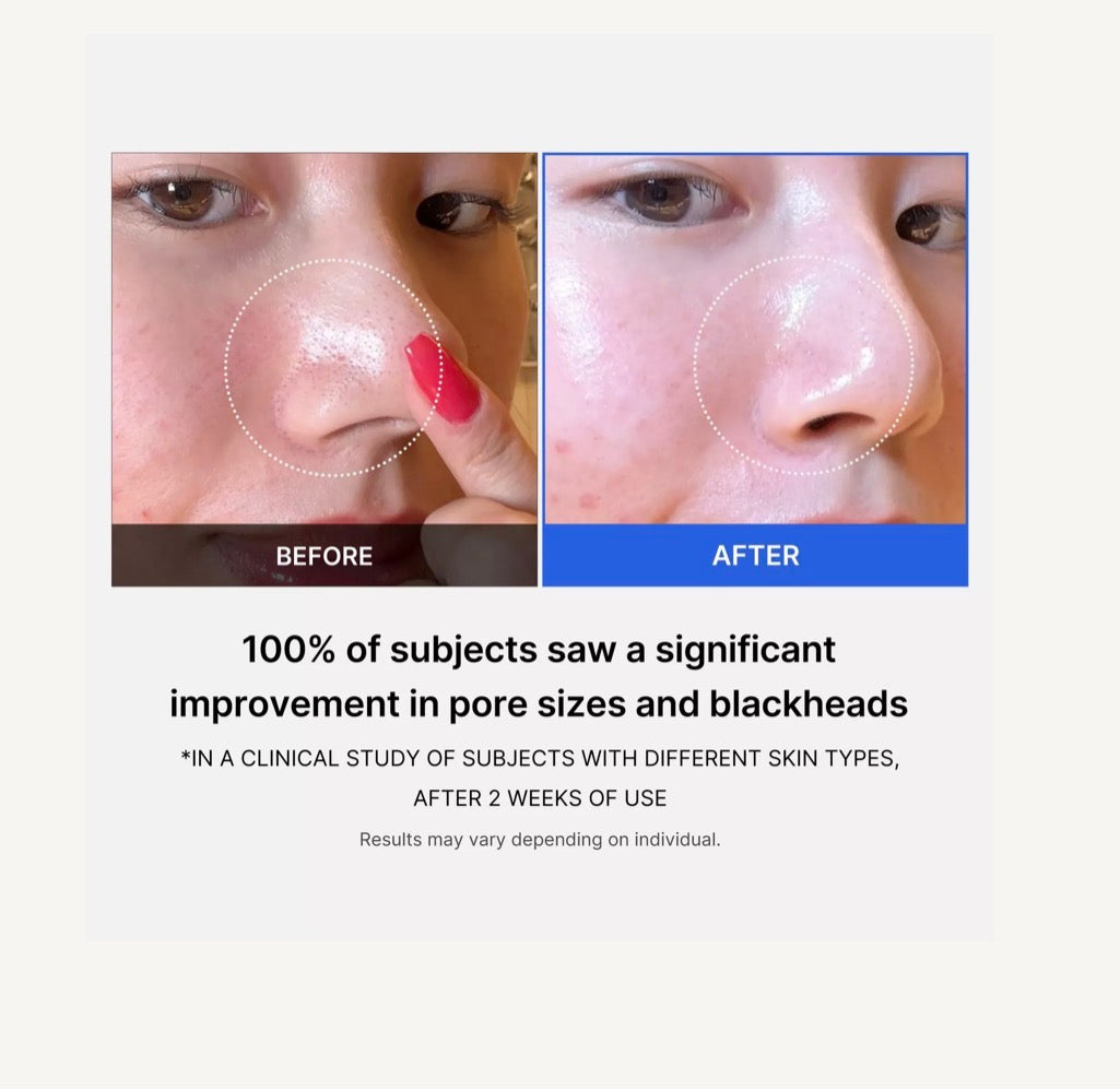Zero Pore Pad 2.0 (70 pads)