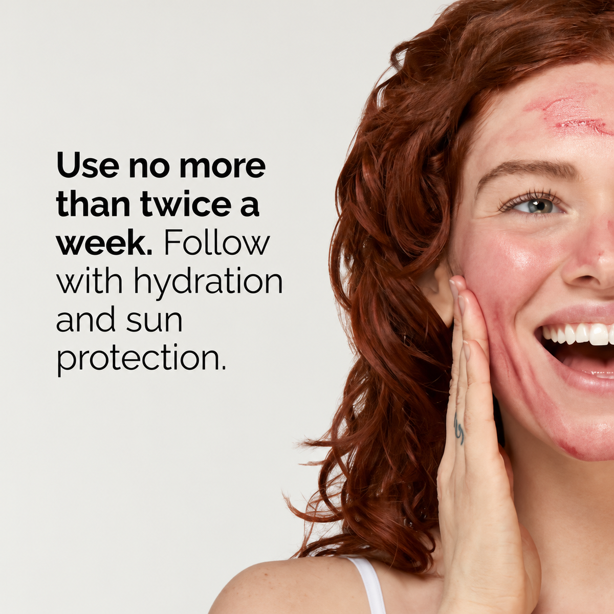 AHA 30% + BHA 2% Peeling Solution Advanced Exfoliating