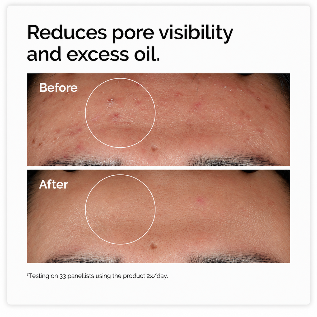 10% Niacinamide + 1% Zinc Serum