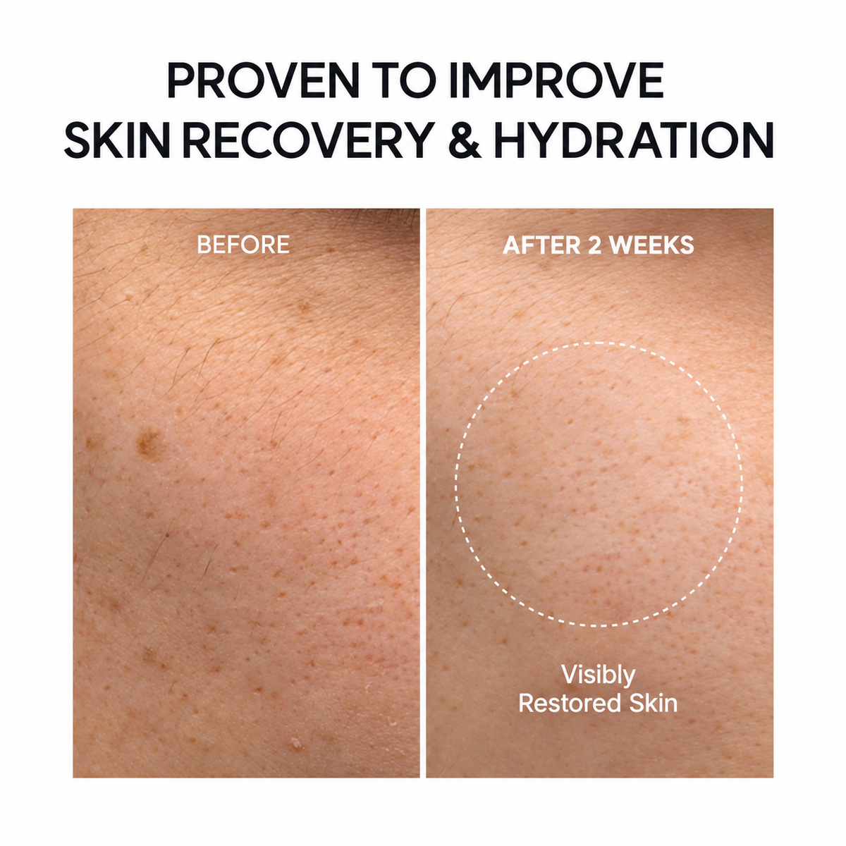 PDRN Booster Shot Serum with Rosy & Peptides For Dark Spots