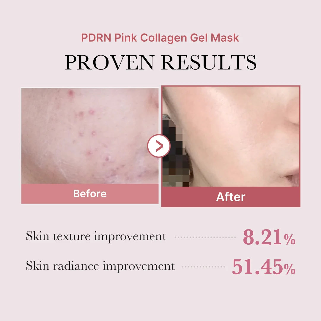 Salmon DNA PDRN pink collagen mask  for glass glow skin